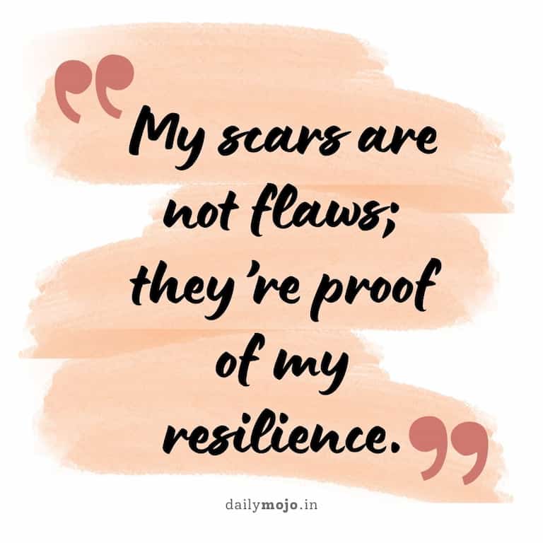 My scars are not flaws; they're proof of my resilience